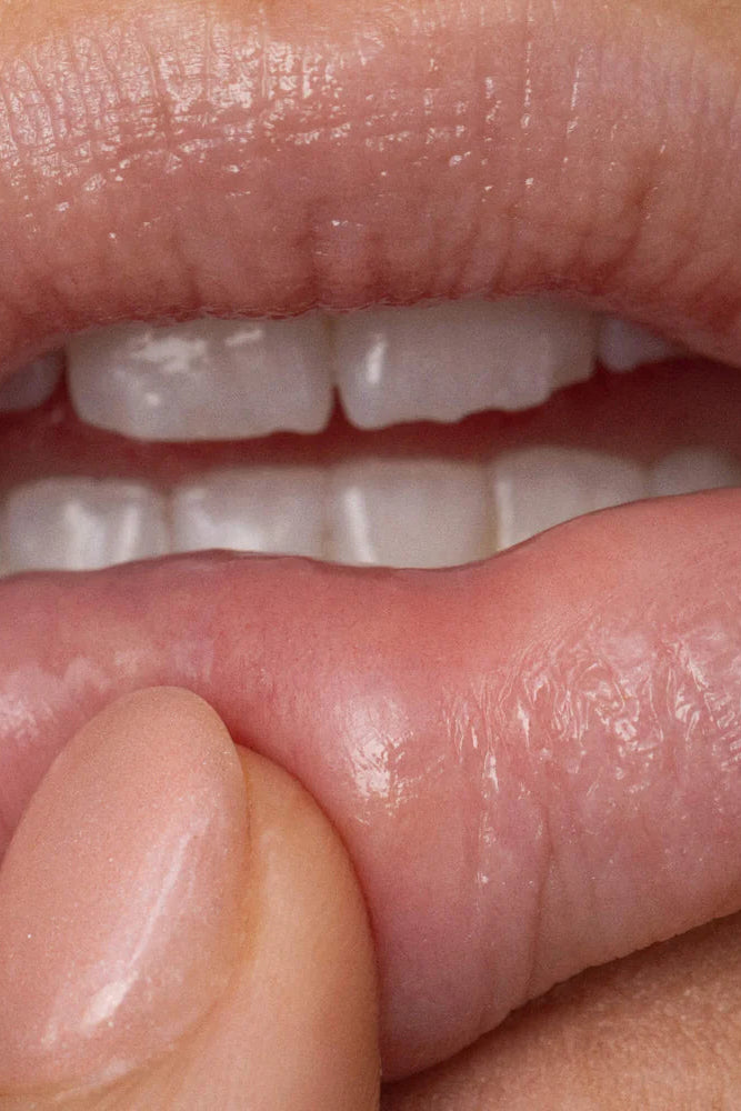 Lip Balm